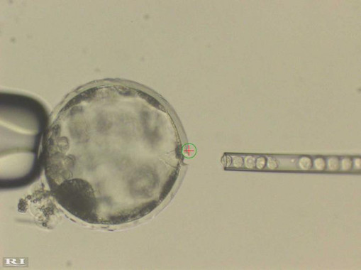 <p>Inyección de células pluripotentes humanas en un blastocito de cerdo. / Juan Carlos Izpisua Belmonte</p>