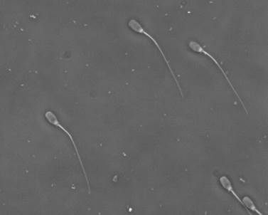 Foto de espermatozoides de mamíferos, en un fondo gris oscuro, se ven los espermatozoides con sus colas largas y rectas.