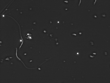 Foto de espermatozoides de caimán, en un fondo negro, se ven los espermatozoides con sus colas largas y en forma de S.