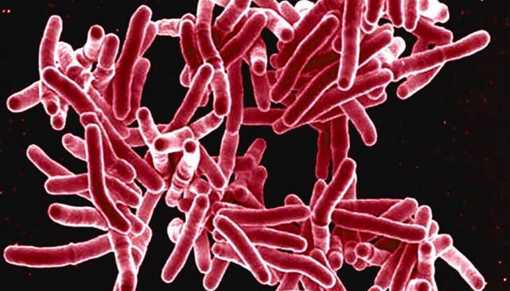 Foto de una agrupación de bacterias, en un fondo negro algo parecido a gusanos rosados.