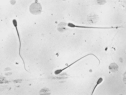 Foto de microcoscopio de espermatozoides de toros vsitos.